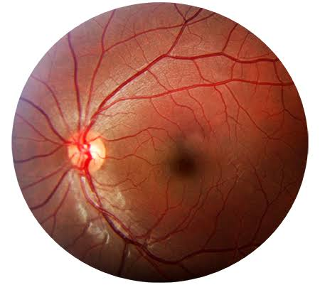 Imagen clínica de retina